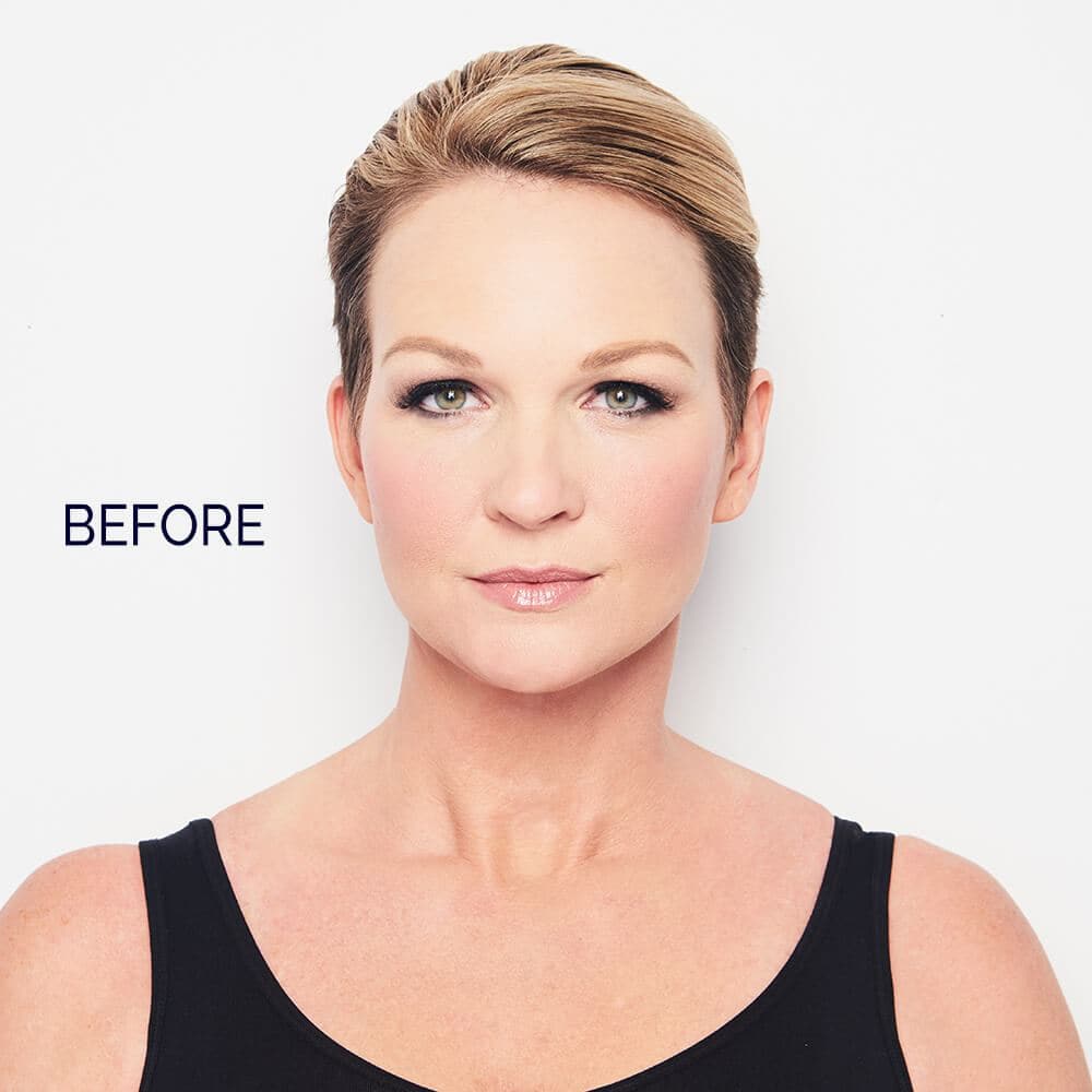 SONATA TOPPER - Image 8